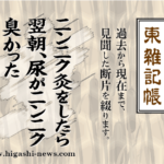 東 雑記帳 － ニンニク灸をしたら翌朝、尿がニンニク臭かった