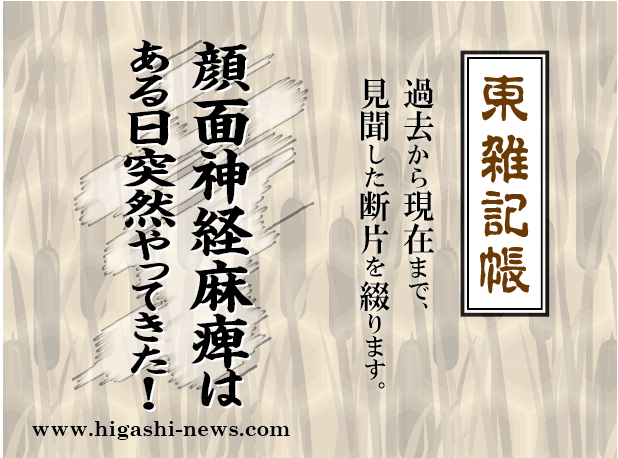 東 雑記帳 － 顔面神経麻痺はある日突然やってきた！